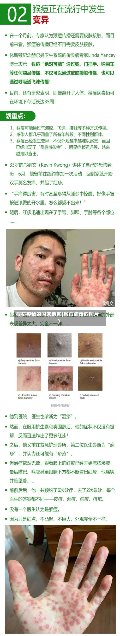 猴痘疫情的国家地区(猴痘病毒的图片)-第2张图片